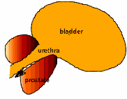 Benign Prostatic Hyperplasia